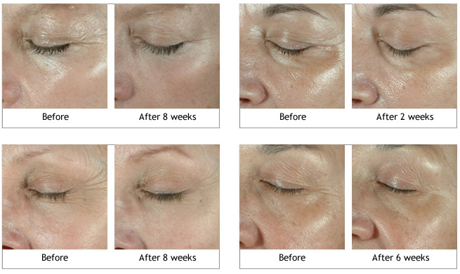 Obagi ELASTIderm Eye Treatment